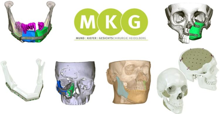 Individueller-3D-Druck-f-r-Patienten-in-der-Mund-Kiefer-und-Gesichtschirurgie