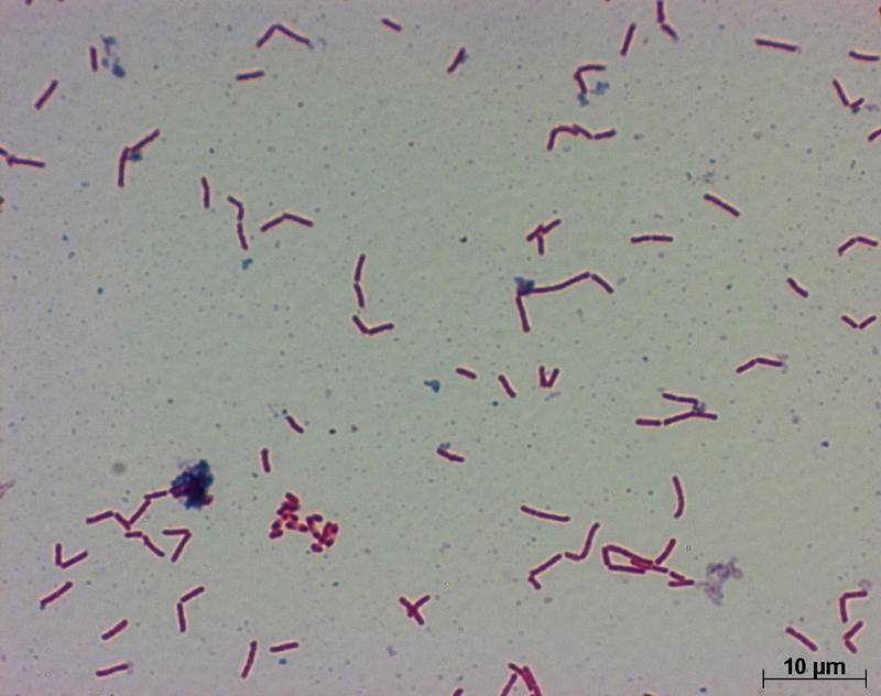 Клостридиум. Клостридии bifermentans. Клостридиум Сорделли. Бактерия Clostridium pasteurianum.